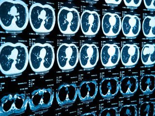 The Benefits of Cardiac CT Angiogram: Insights from Harris Park Radiology.