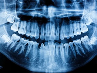 OPG or Dental X-Ray at Crystal Radiology.