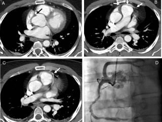 Diagnosing Heart Disease through Cardiac CT Scans at Harris Park Radiology.