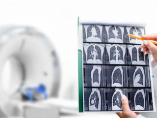 CT scan: What does it detect?