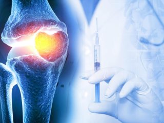 How Good Is Euflexxa for Knee Injections?