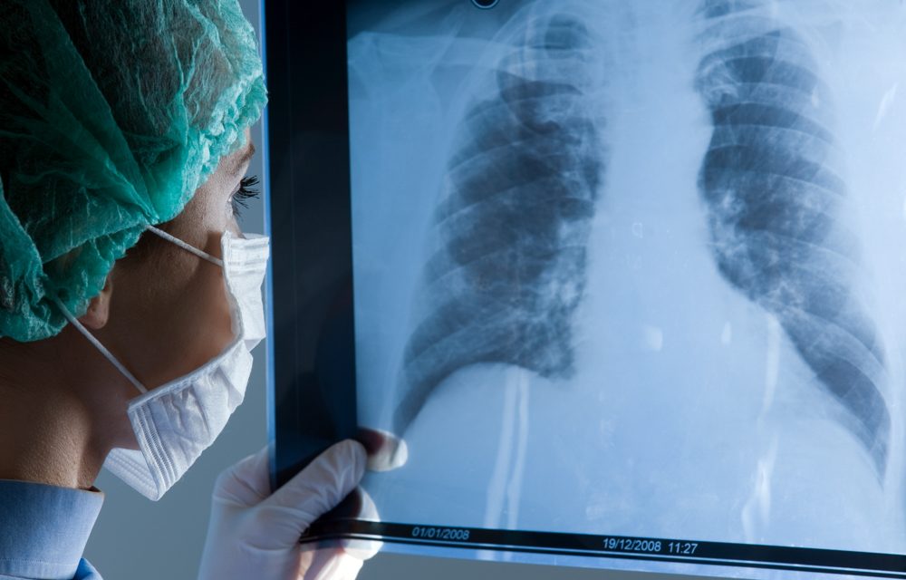 Best X-Ray Services in Auburn