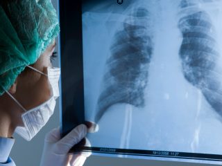 Why Crystal Radiology Offers the Best X-Ray Services in Auburn, NSW.