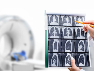 How Lung CT Scan Services at Crystal Radiology Help Detect Disease Early.