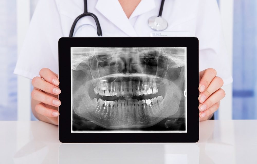 Dental X-rays at Crystal Radiology