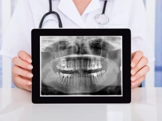 Crystal Radiology Insights: Understanding Dental X-rays and How They Help.