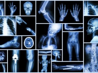 X-Rays in Orthopedic at Crystal Radiology.