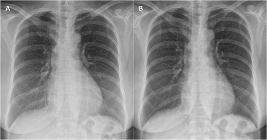 Low-Dose Digital X-Rays at Crystal
