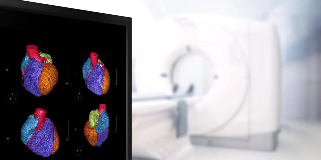 Cardiac CT Imaging at Crystal Radiology