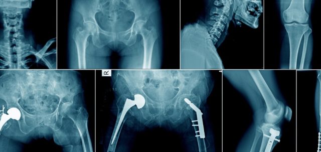 Get X-rays done at Crystal Radiology | X-ray services at crystal