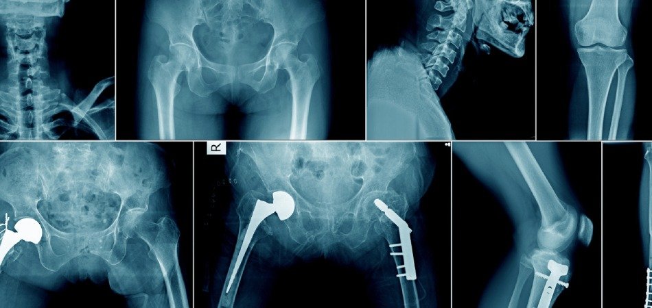 Get X-rays done at Crystal Radiology
