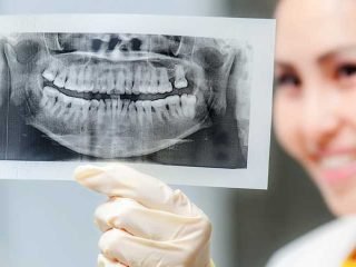 How Often Are OPG X-Rays Taken and Why? – Crystal Radiology.