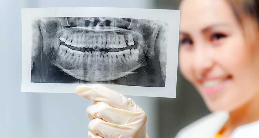 OPG X-rays taken at Crystal Radiology