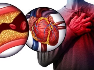 How is Coronary Artery Disease Tested in Auburn?