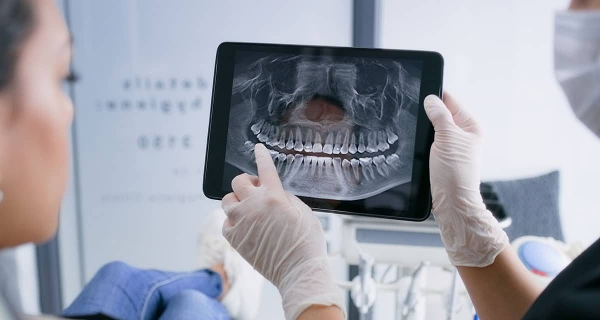 dental xray opg near me