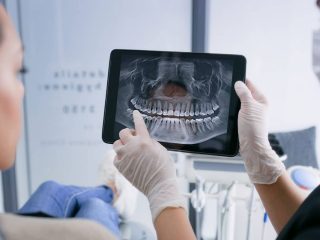 Tooth Pain or Jaw Swelling? Find Answers Fast with Dental OPG X-ray at Crystal Radiology.