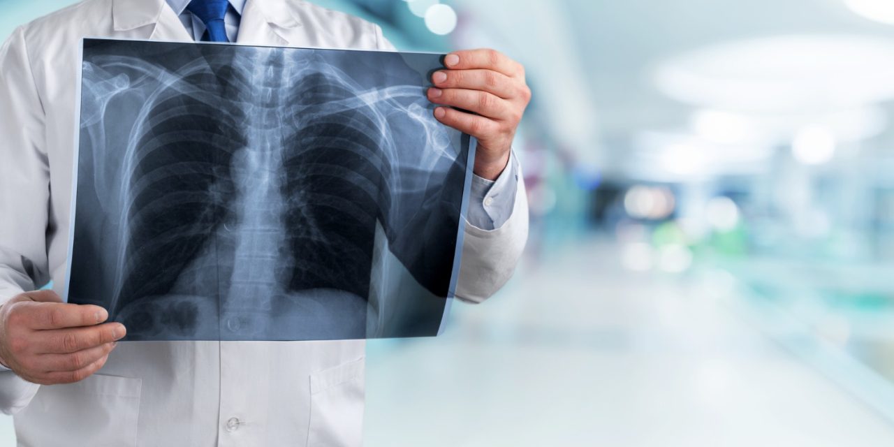 Booking X-Ray Appointments Online at Crystal Radiology