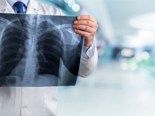 Booking X-Ray Appointments Online for All Ages at Crystal Radiology.