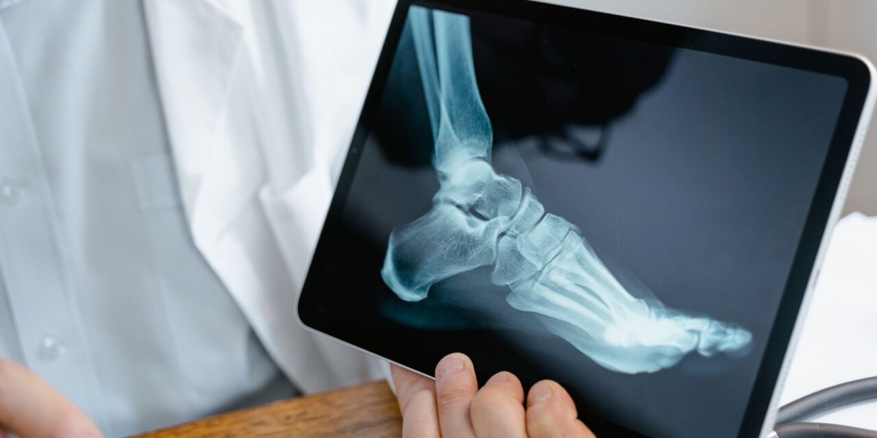 X-rays in Podiatry at Crystal Radiology