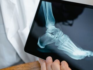 X-rays in Podiatry at Crystal Radiology: The First Step to Accurate Foot and Ankle Diagnosis.