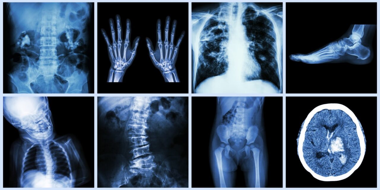 Bulk Billed X-Rays at Crystal Radiology
