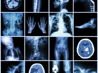 How X-Rays Help Diagnose Everyday Injuries and Conditions at Crystal Radiology.